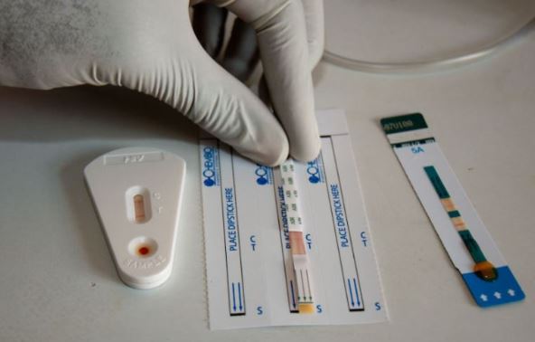 HIV testing & treatment